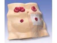 Model do pielęgnacji stomii