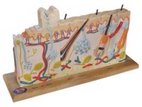 Przekrój ludzkiej skóry z patologią oparzeń - 3B