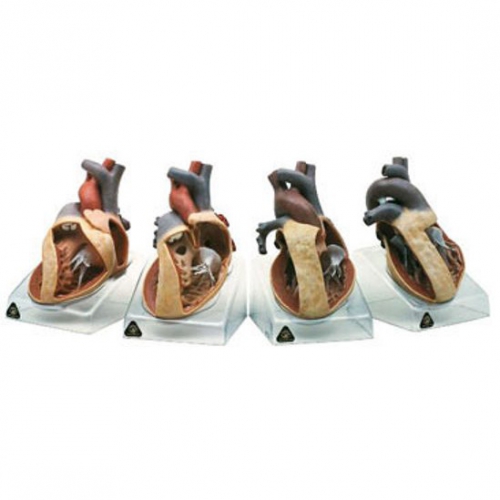 Seria Modeli - Wady Serca