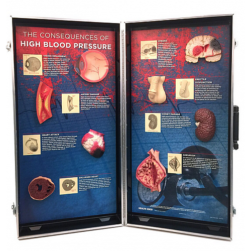 Tablica edukacyjna - Konsekwencje nadciśnienia