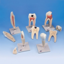 Seria modeli zębów