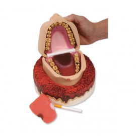 Jama ustna palacza - model demonstracyjny