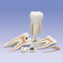 Duży Model Zęba Trzonowego