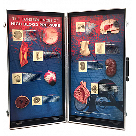 Tablica edukacyjna - Konsekwencje nadciśnienia