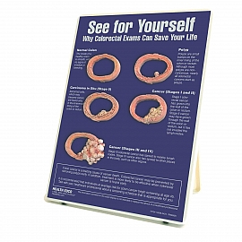 Tablica edukacyjna - nowotwór jelita grubego